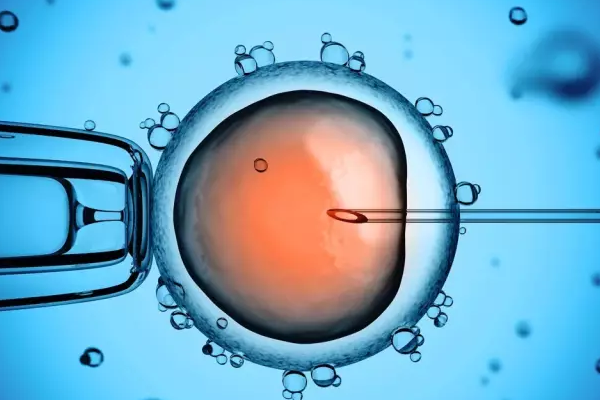 试管婴儿技术（IVF）