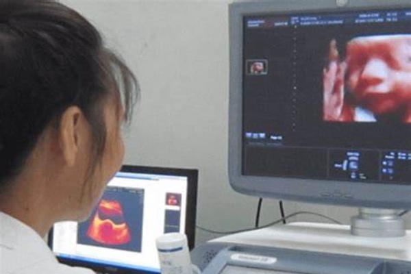 四维彩超如何帮助你了解宝宝的发育情况？
